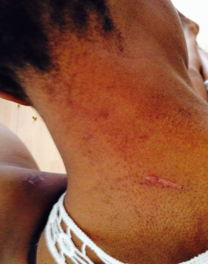 Femme noire agressée