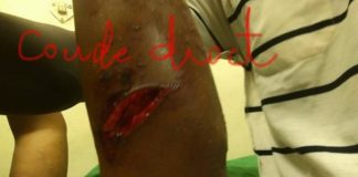 Drame de la polygamie : à Pikine, Oumou Diop, 35 ans, charcutée par sa co-épouse à coups de hache la veille de sa nuit de noces