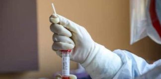 Covid-19 au Sénégal : 177 cas positifs révélés ce lundi