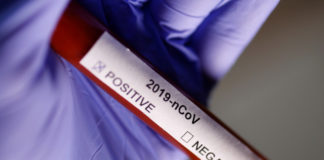 Covid-19 au Sénégal : 83 nouveaux cas positifs et 59 patients guéris déclarés