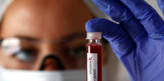 Covid-19 au Sénégal : 109 nouvelles contaminations enregistrées