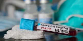 Kenya : Refus des tests par peur de la mort