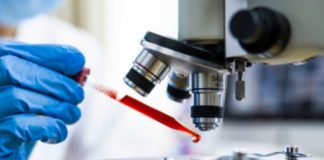Covid-19 au Sénégal : 92 nouveaux cas positifs, 106 patients guéris