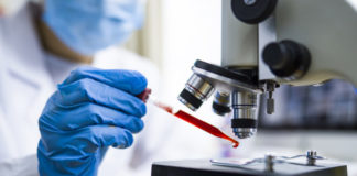 Covid-19 au Sénégal : 96 cas positifs, 109 patients guéris et 2 décès enregistrés