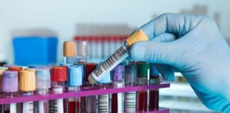 Covid-19 au Sénégal : 128 cas positifs, 4 décès, 157 guéris, 48 patients en réanimation