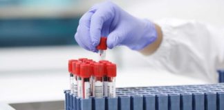 Covid-19 au Sénégal: 223 tests positifs dont 208 militaires, 1 décès, 28 patients en réanimation