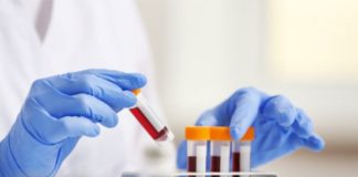 Covid-19: Le monde entre dans une période difficile, selon l’OMS