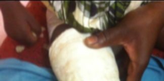Amadou Barry fracture le genou de son employé, à Goundo Global Service