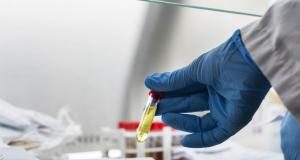 Covid-19 au Sénégal: 66 nouveaux tests positifs, 1 décès, 28 cas graves en réanimation
