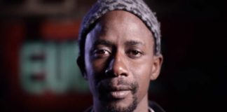Fou Malade victime d’un accident : une épaule cassée