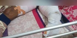 Yaoundé : elle ébouillante le sexe de son mari