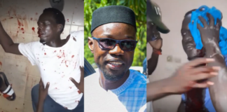 Ziguinchor : sanglante bataille entre pro-Sonko et pro-Doudou Ka
