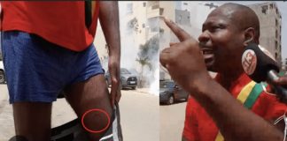 POLITIQUE : Venu soutenir Sonko placé en résidence surveillée, le député Guy Marius Sagna reçoit un projectile de la police