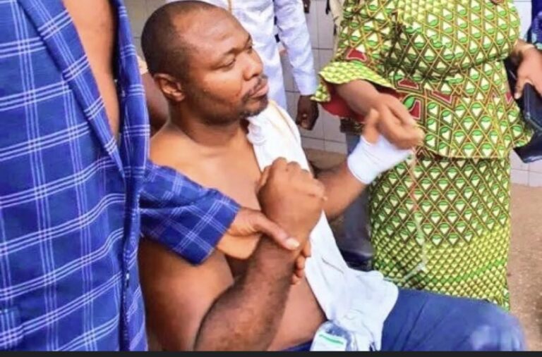 TOGO : Le député Guy Marius Sagna agressé !